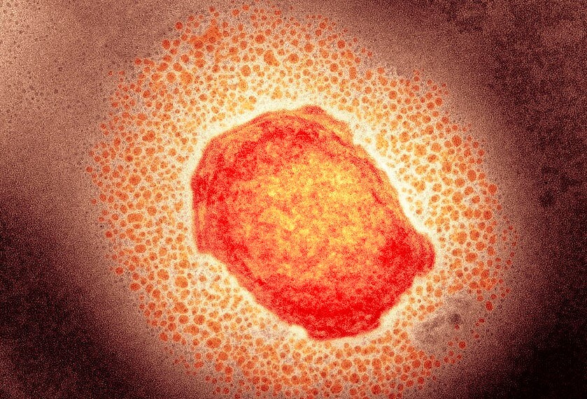 monkeypox-virus