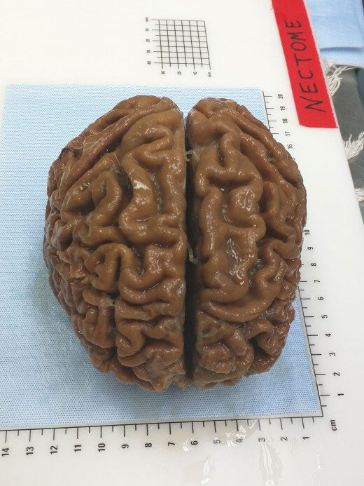 preserved-brain-NECTONE 