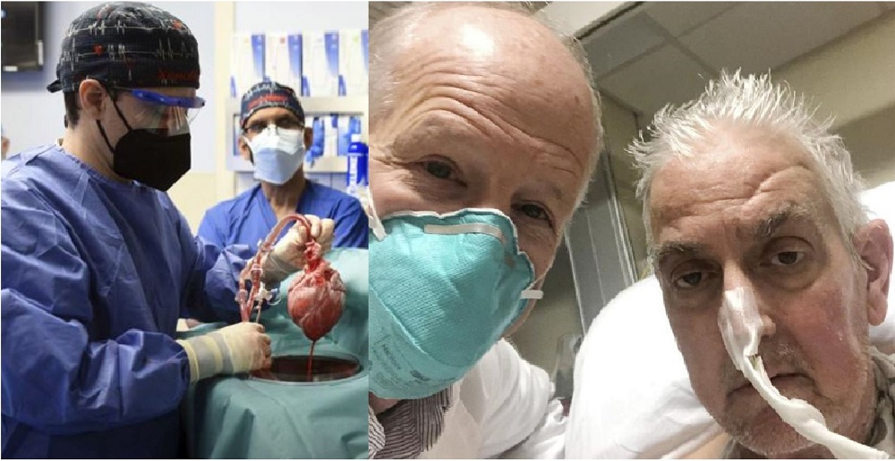 U.S Surgeons Save Dying Man With Pig Heart – The Whistler Nigeria