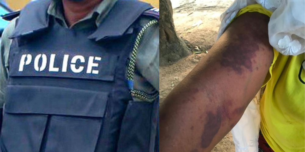 Nigeria-Police-Force-and-Injured-arm-of-Mrs-Jimoh
