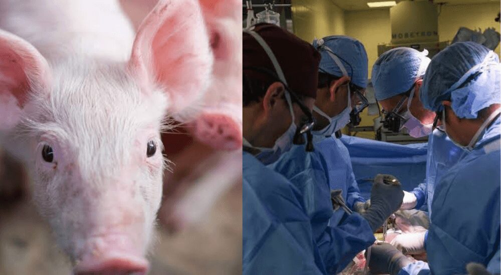 L-R, A Pig, Surgeons Conducting A Surgical Operation